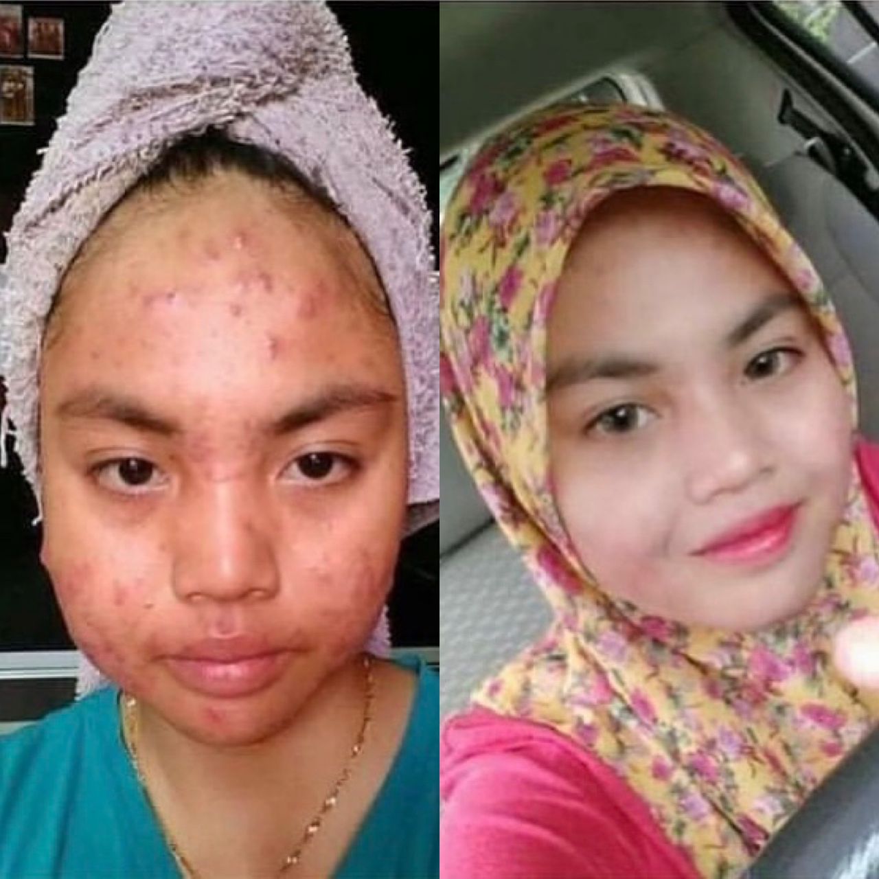Testimoni